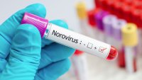 Qué es el norovirus y por qué alertan sobre el aumento de contagios en EEUU