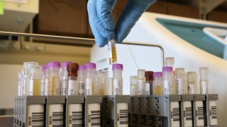 In this Feb. 12, 2021, file photo, researchers at the UW Medicine Retrovirology Lab at Harborview Medical Center work on samples from the Novavax phase 3 COVID-19 clinical vaccine trials in Seattle, Washington.