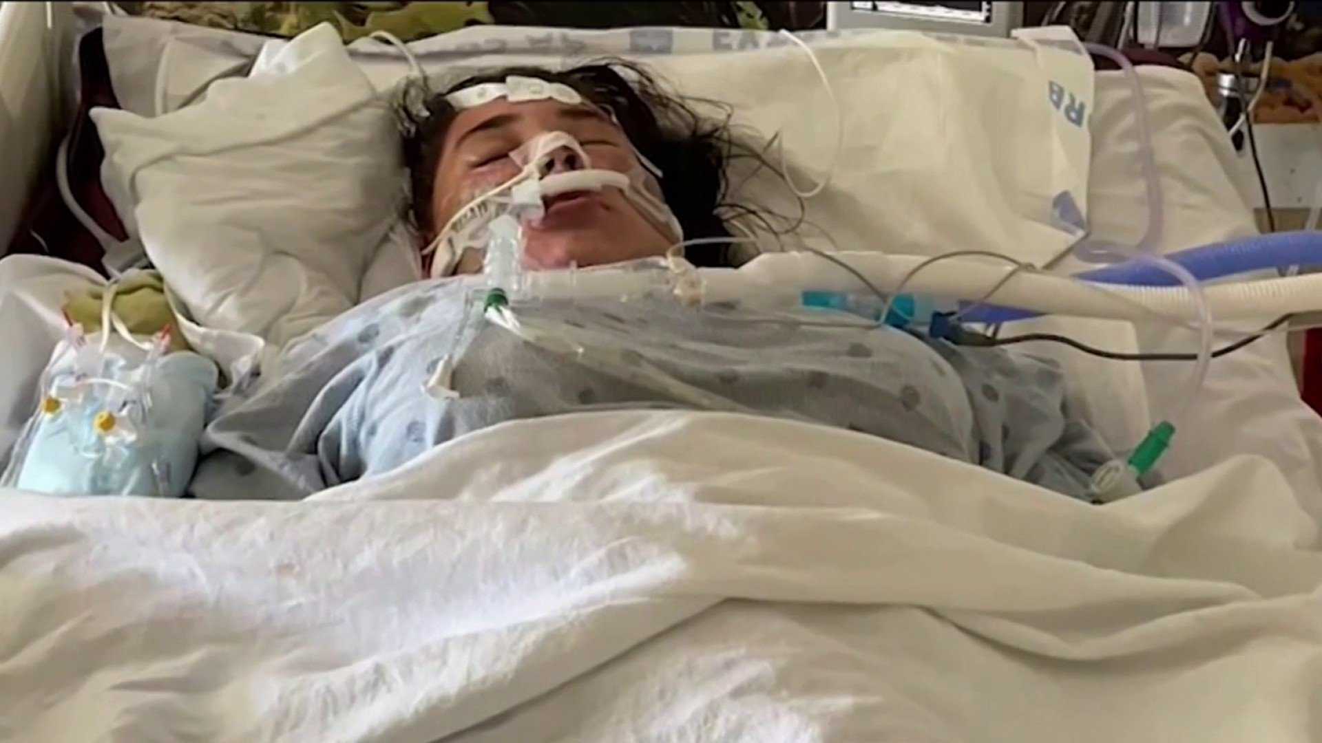 Adolescente hispana en coma por COVID-19 – Telemundo Denver - Vimarsana News