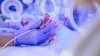 Estudio: los médicos esperan que más bebés microprematuros sobrevivan en el futuro