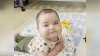 Un bebé de origen hispano atraviesa numerosas cirugías en el corazón para sobrevivir