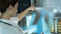 Woman radiology doctor examining chest x-ray film of patient in health care medical laboratory at hospital